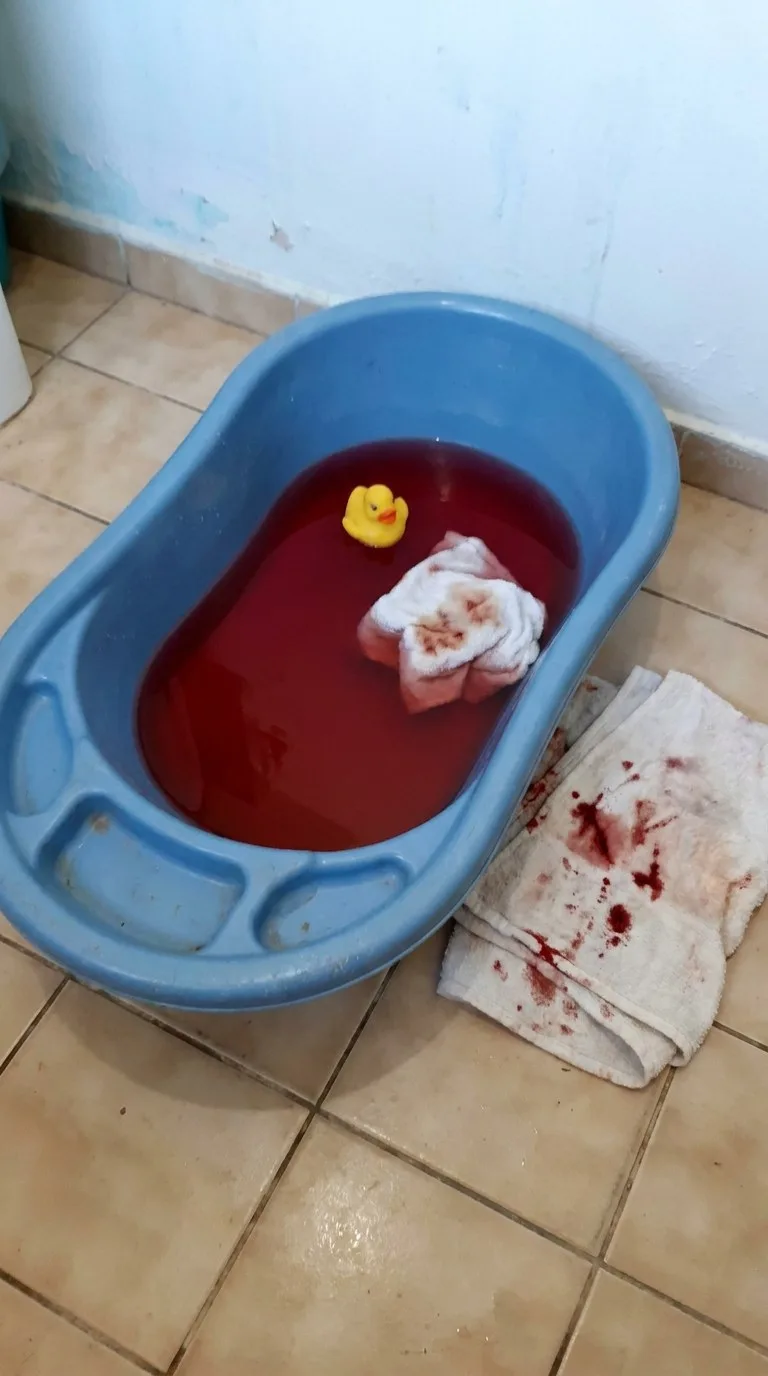Banheira de bebê com a água avermelhada e toalhas manchadas no chão do banheiro